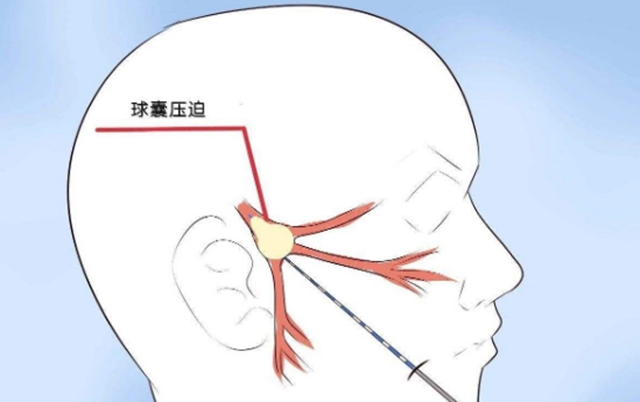 瀘州一老人臉被“刀割”，痛不欲生！(圖7)