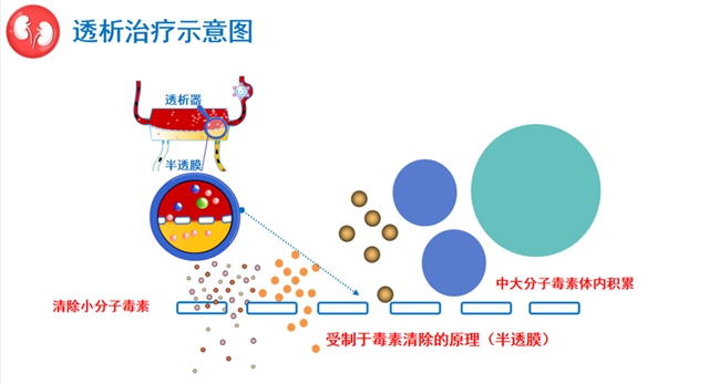 尿毒癥患病率高達(dá)萬分之9左右！該如何保護(hù)你的腎？(圖3)