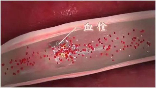 【分享】雞蛋的又一好處被發(fā)現(xiàn)，怎么吃有講究！