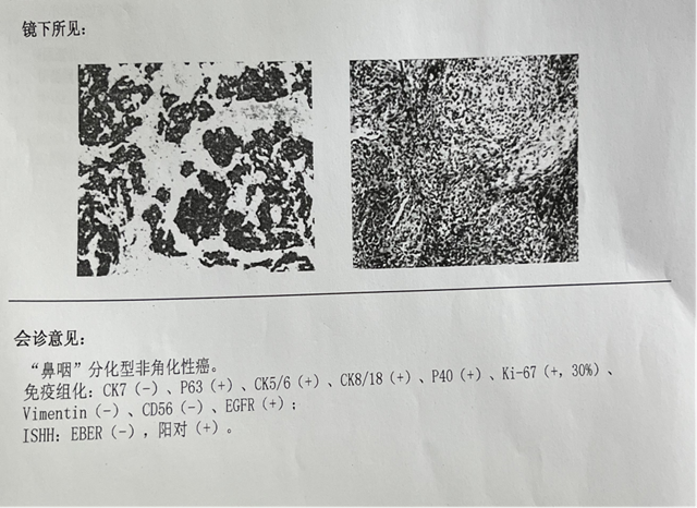 【圍觀】?jī)H三個(gè)月，腫瘤就消失了，癌癥有那么可怕嗎？