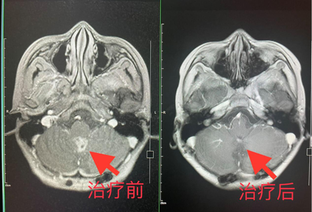 【擴(kuò)散】2名瀘州孃孃腦殼長(zhǎng)“包”？