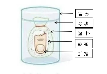 【?？萍夹g(shù)】驚心！又是電鋸！裝修師傅們千萬要小心了！