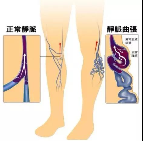 【圍觀】瀘州女教師小腿酸痛1個(gè)月，一雙美腿險(xiǎn)些毀掉(圖5)