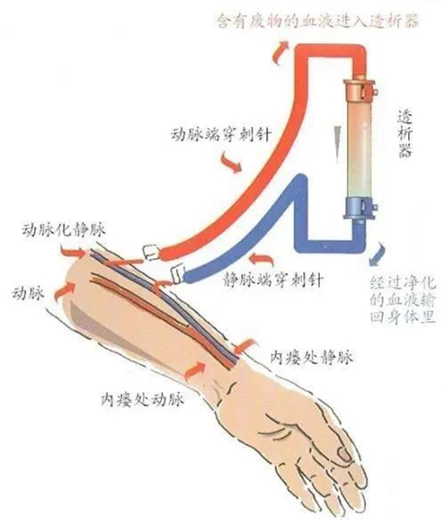 好消息！6月5日，西南醫(yī)科大學(xué)附屬醫(yī)院通路組專家下基層到福欣醫(yī)院！(圖1)